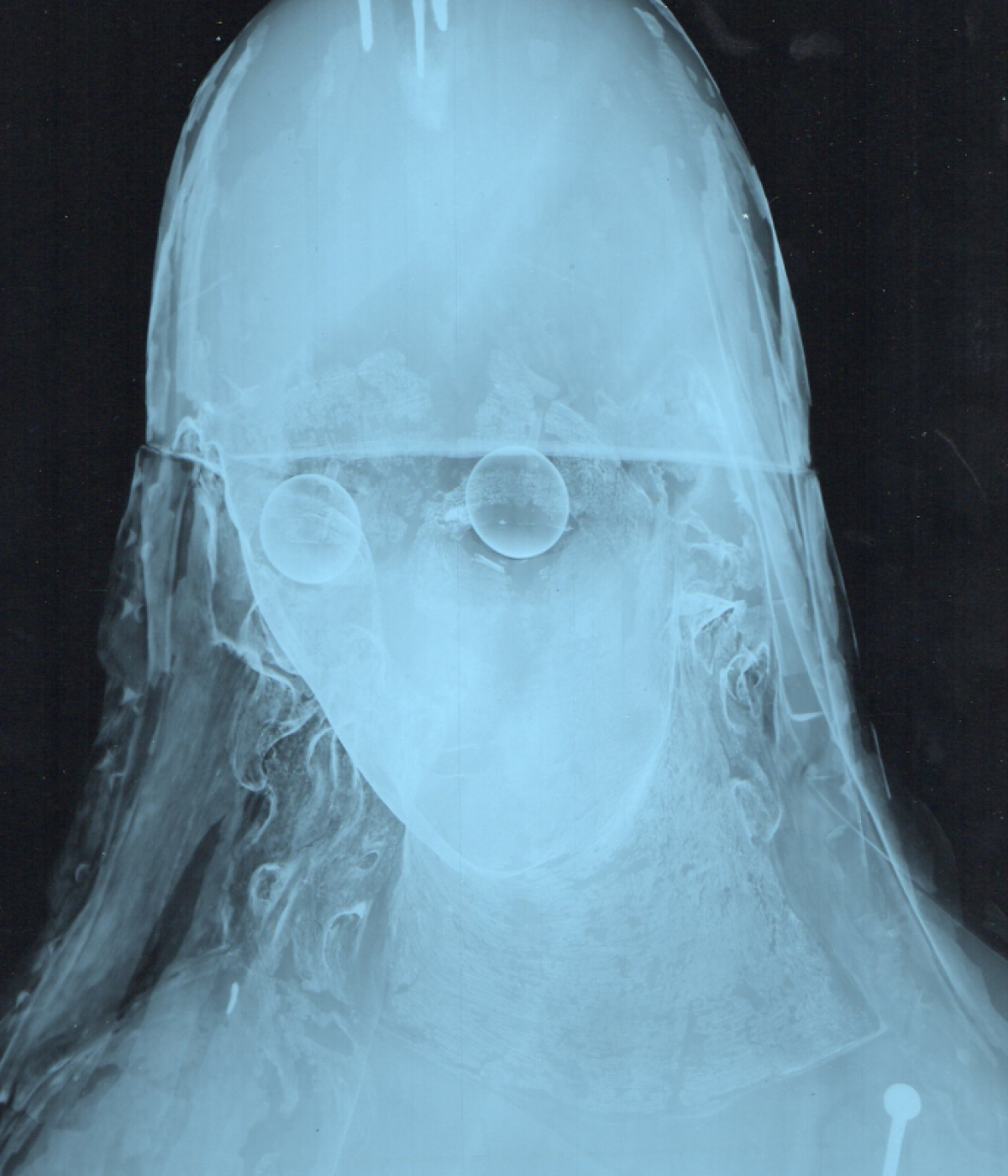 Glasaugenmadonna in der Röntgenuntersuchung